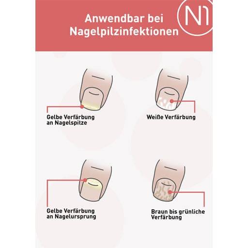 N1 nail fungus solution
