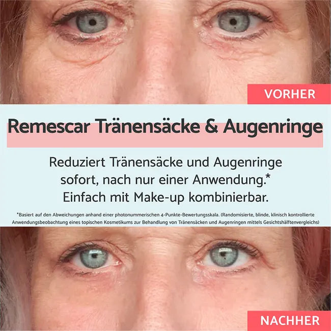 REMESCAR Eye Bags and Dark Circles Eye Cream