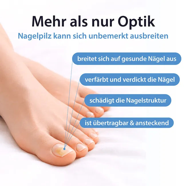 ACETOCAUSTIN nail fungus solution against nail fungus & for visibly better nails 5 ml