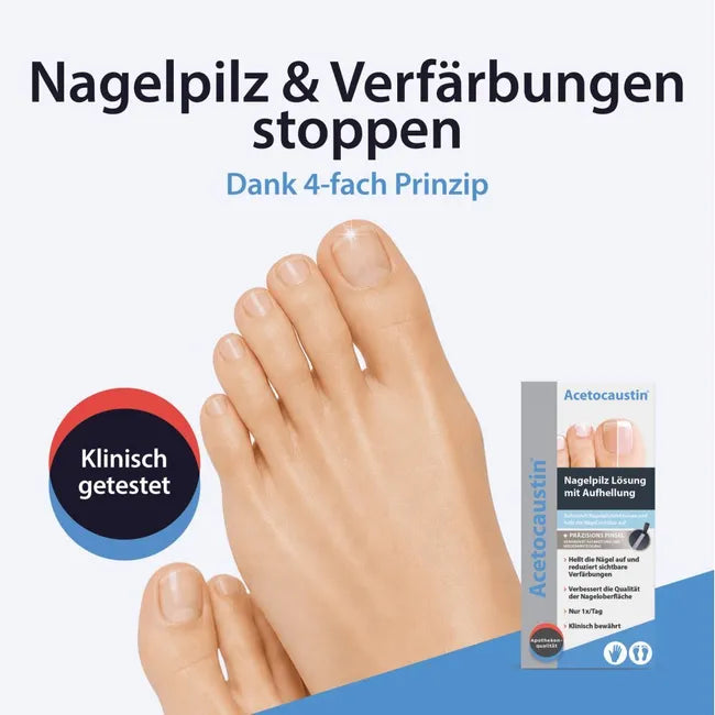 ACETOCAUSTIN nail fungus solution with whitening effect against discolored nails