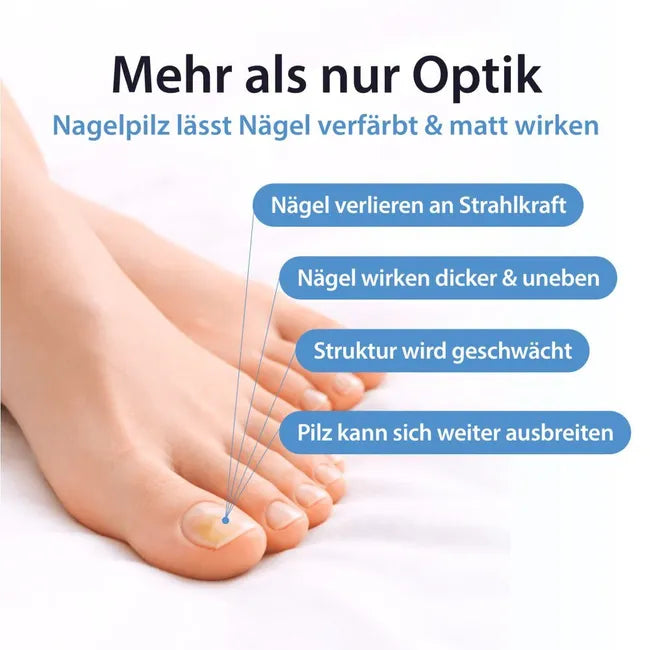 ACETOCAUSTIN nail fungus solution with whitening effect against discolored nails