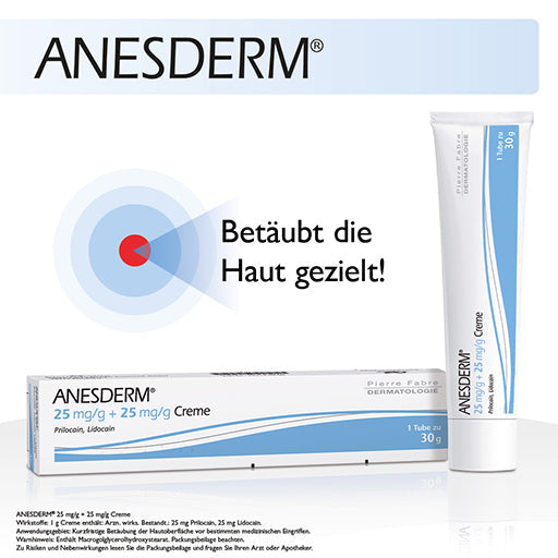 ANESDERM 25 mg-g + 25 mg-g Cream + 10 Patches
