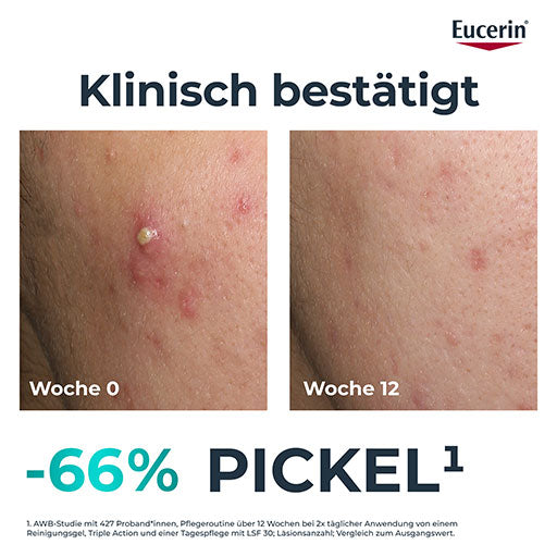 EUCERIN DermoPure Clinical Triple Action Cream
