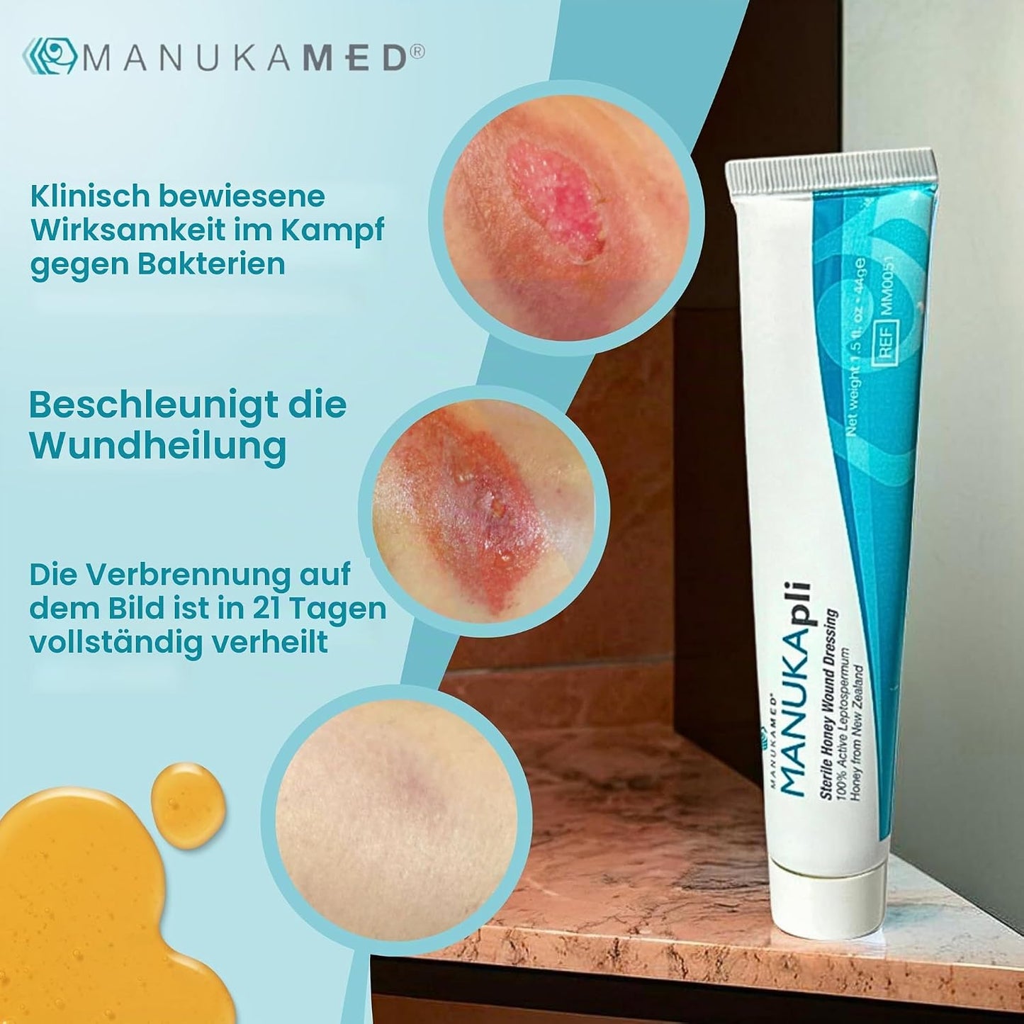 ManukaMed MANUKApli Wound and Healing Ointment (1 x 44 g)