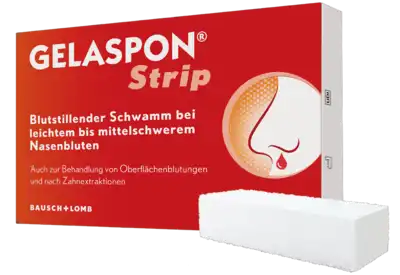 Nosebleeds in children, nosebleed, hemostasis, tooth extraction, GELASPON Strip